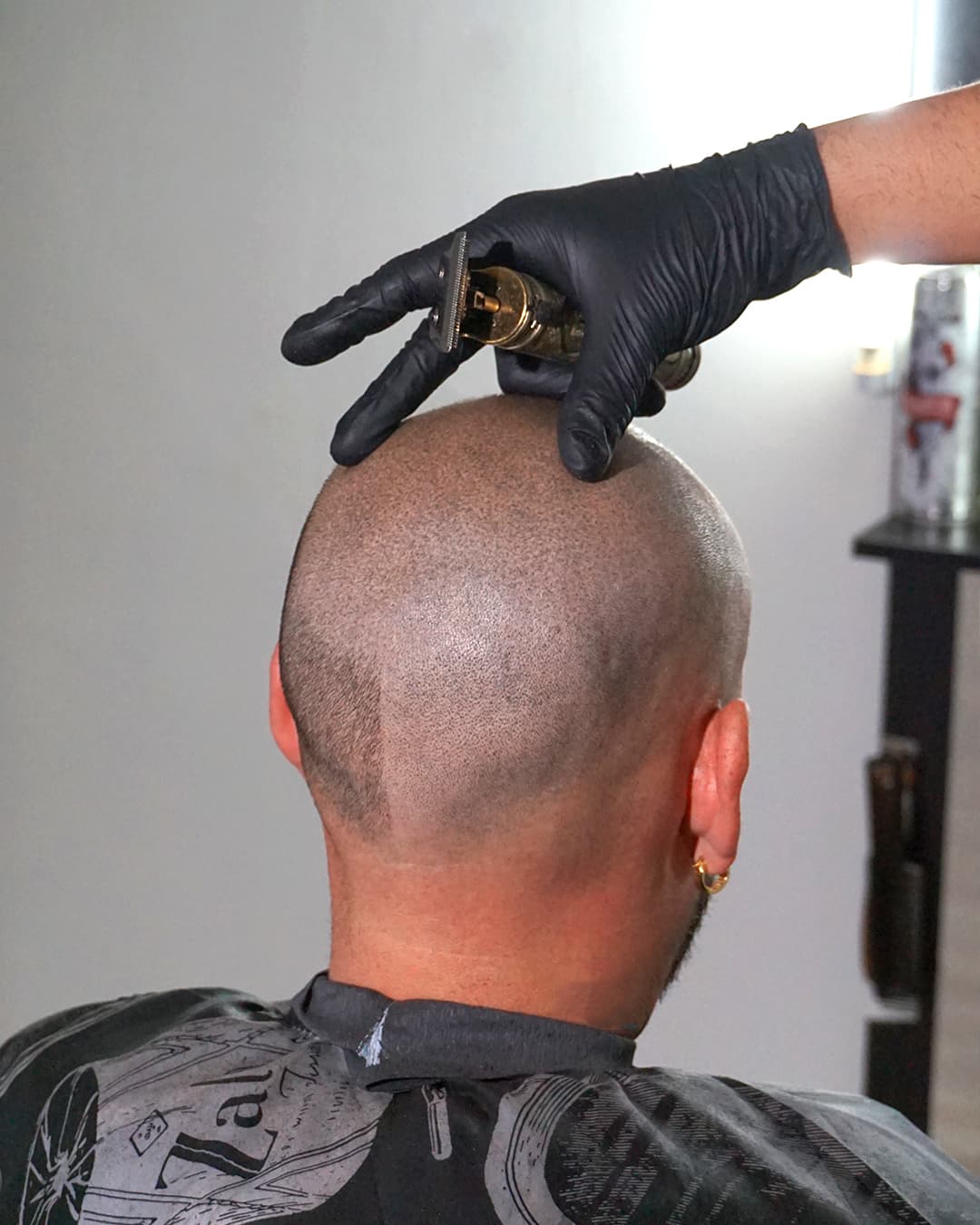 Preparación de la zona posterior del cuero cabelludo antes de una sesión